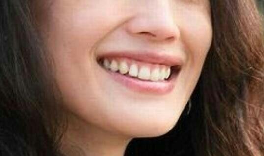 骰子嘴唇猜明星,揭秘骰子嘴唇背后的明星故事